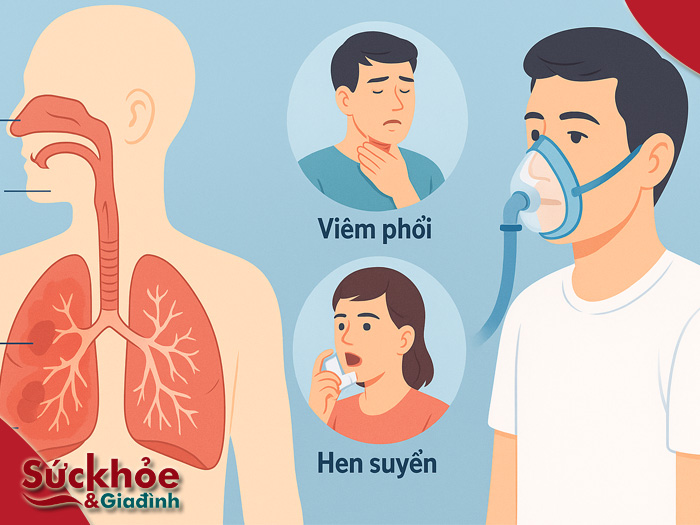 Bệnh hô hấp