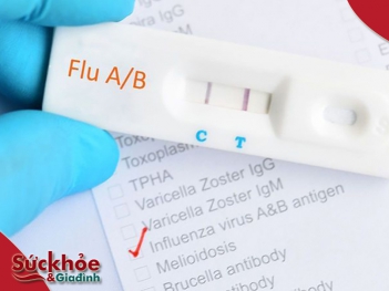 Cách test cúm A bằng que thử tại nhà có chính xác không? - Sức khỏe và Gia đình
