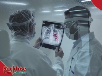 Viêm phổi gây suy hô hấp triệu chứng và cách xử lý - Sức khỏe và Gia đình