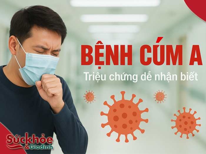 bệnh cúm a